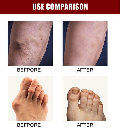 Perfectx Joint And Bone Therapy Cream